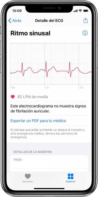 apple watch ecg app-smartwatch con ecg