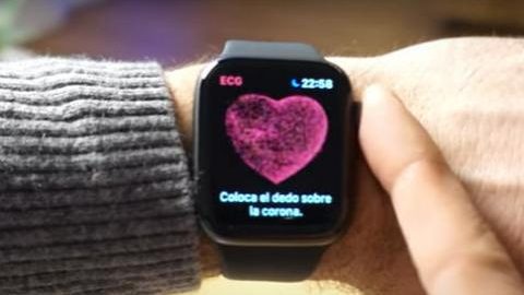 smartwatch ecg-salud y bienestar